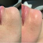 مژگان اسکین کرMojgan skincare