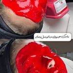 فروش محصولات وتجهیزات مراقبت پوستی