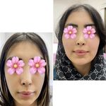 کلینیک زیبایی الماس کاملا اقساطی