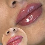 مرکز لیزر ،پوست و زیبایی کندی بیوتی