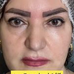 کلینیک زیبایی آرامو