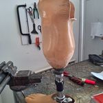 کلینیک اسکن پا غرب تهران صافی و خارپاشنه