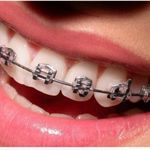 بیمه دندانپزشکی نوین سلامت