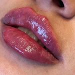 کلینیک زیبایی و لیزر دکتر افسانه حُبّی