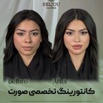 کلینیک زیبایی بلژو