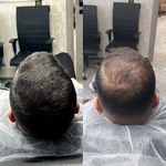 مرکز تخصصی میکرو اسکالپ