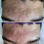 فیشیال و پاکسازی پوست تالگو فرانسه