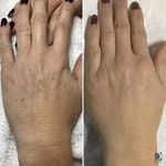 فیشال و پاکسازی تخصصی پوست سودی ثبتی