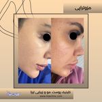 کلینیک زیبایی لیزا