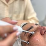 فیشال و پاکسازی پوست | رویا صالحی