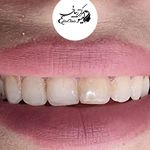 کلینیک دندان پزشکی و ایمپلنت الیسو