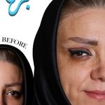 کلینیک زیبایی برنا