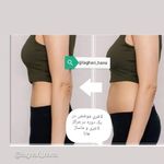 مرکز لاغری و ماساژ هانا