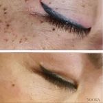 کلینیک زیبایی نورا