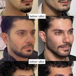 کلینیک پوست،مو،زیبایی،مرکز لیزر ‌پرنسا