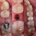 دنداپزشکی دکتر یاشار معزز