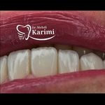دندانپزشکی و ایمپلنت دکتر مهدی کریمی