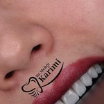 دندانپزشکی و ایمپلنت دکتر مهدی کریمی
