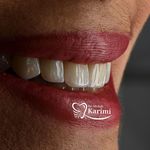 دندانپزشکی و ایمپلنت دکتر مهدی کریمی
