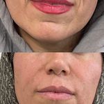 مطب پوست ،مو و لیزر دکتر ستارپور