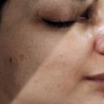 فیشیال / خدمات پوست / سالن زیبایی