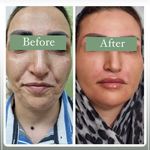 کلینیک زیبایی دکتراحمدقدیانفر