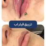 کلینیک زیبایی و جوانسازی پوست و مو الین