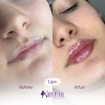 کلینیک لیزر و زیبایی نیلوفر