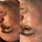 آموزش و خدمات پوست و فیشال رویا باقریان