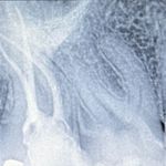 دکتر بیتا فتحی متخصص درمان ریشه