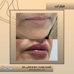 مطب پوست مو زیبایی فردوس شرق