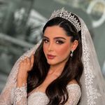 زیبایی وستا
