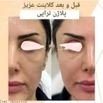 فیشال و پاکسازی تخصصی ساتی