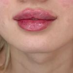 کلینیک پوست ، مو و زیبایی الیزا