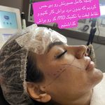 کلینیک زیبایی، پوست و مو نچرال بیوتی