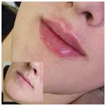 کیلینیک زیبایی الا