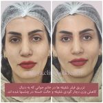 کلینیک زیبایی و لیزر مایا (دکتر وحیدی)
