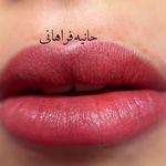 حانیه فراهانی،بنمژه،شیدینگ لب بدون دردقم