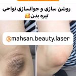 کلینیک لیزر و زیبایی مهسان