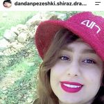 دکتر حسین اکبری دندانپزشک (زیبایی )