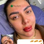 خدمات تخصصی ارایش دائم مونا،میکروبلیدینگ