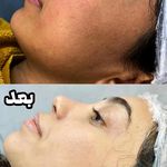 مرکز لیزر،پوست،مو و زیبایی سرو مهر
