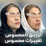 کلینیک زیبایی مانشید