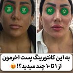 کلینیک زیبایی و مرکز لیزر رُز