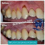 مرکز ایمپلنت ولیزر دندانپزشکی دکتربرجیان