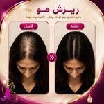 کلینیک پوست و زیبایی ژیلاوَش