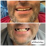 مجموعه دندان پزشکی و دندان سازی نچرال