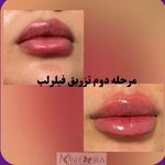 کلینیک زیبایی و مرکز لیزر ماهورا