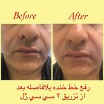 کلینیک زیبایی آذربایجان