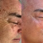 کلینیک زیبایی آزیتا آذر